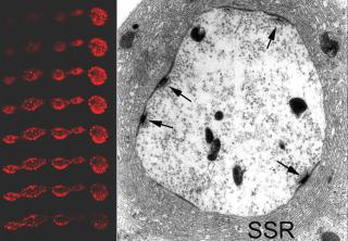 Rechts ein Ultradünnschnitt durch das Endköpfchen einer Synapse der Taufliege: Die Pfeile weisen auf die schwarzen T-förmigen Strukturen, für deren Ausbildung das neu entdeckte Protein Bruchpilot benötigt wird und deren Funktion noch unbekannt ist. Links mehrere optische Schnitte durch synaptische Endköpfchen, die T-förmigen Gebilde sind als rote Punkte sichtbar gemacht. 
Bild: Erich Buchner 
